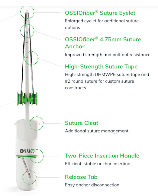 OSSIOfiber® Suture Anchor (Prod 2212111)